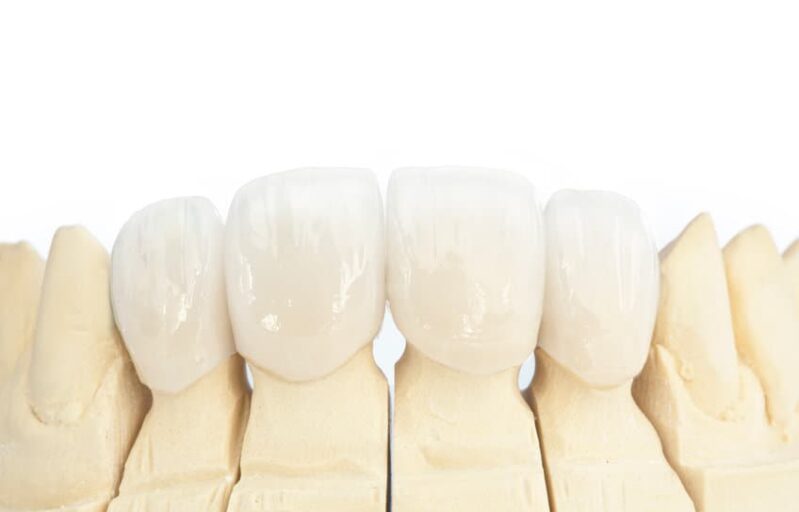 Broken Arrow Best Dentist