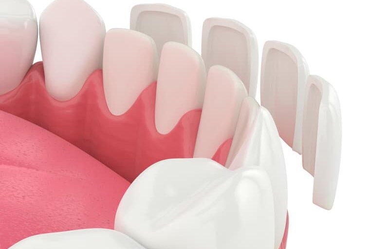 Broken Arrow Dentist
