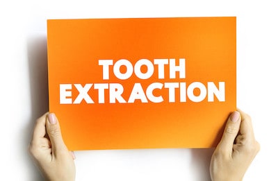 Tooth Extractions in Broken Arrow