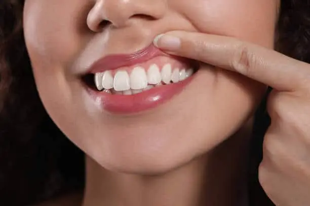 Woman pulling her upper lip back to show her gum line.